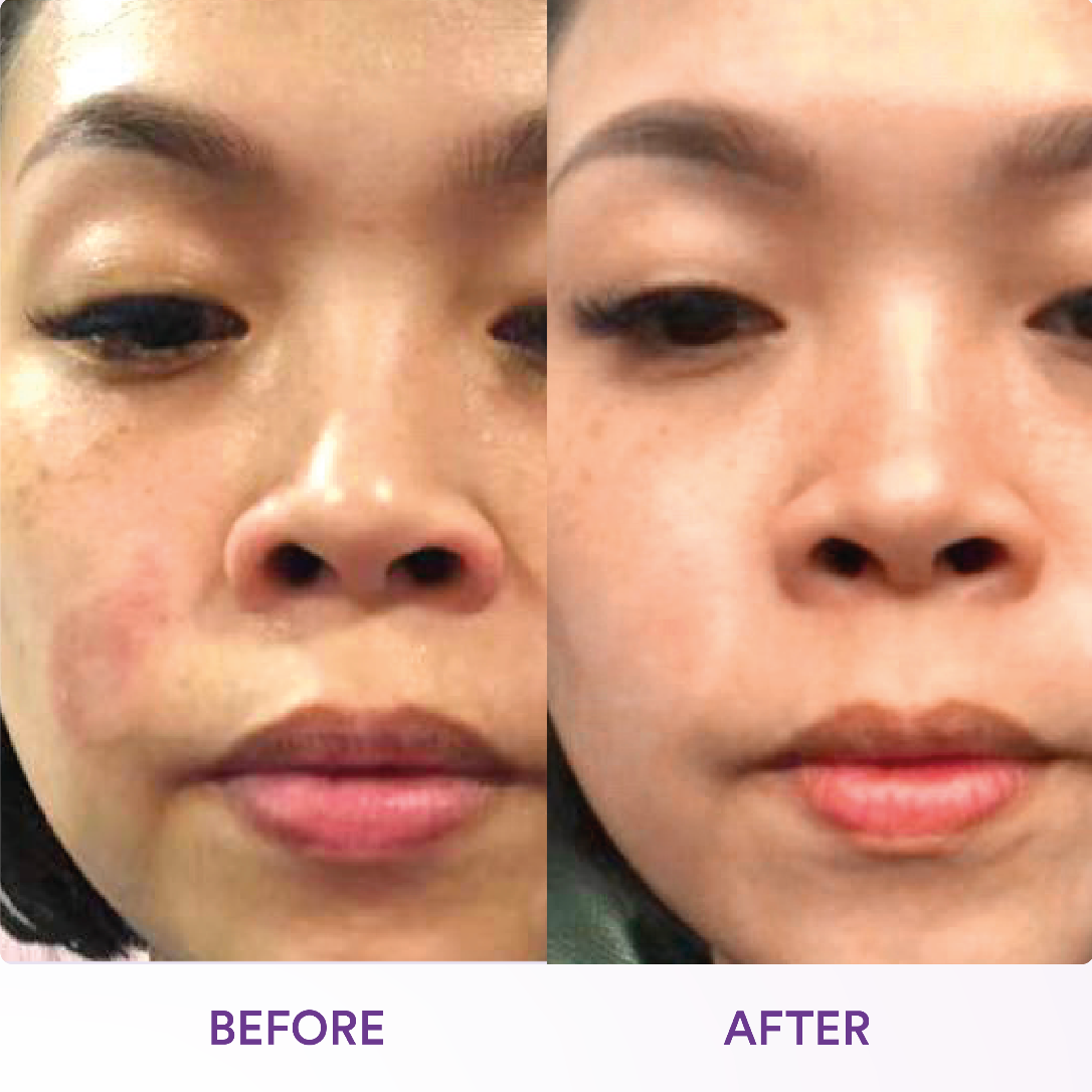 CoQ10 Crystal Clear Hydro Essence Melting Gel Mask (1 Sachet)