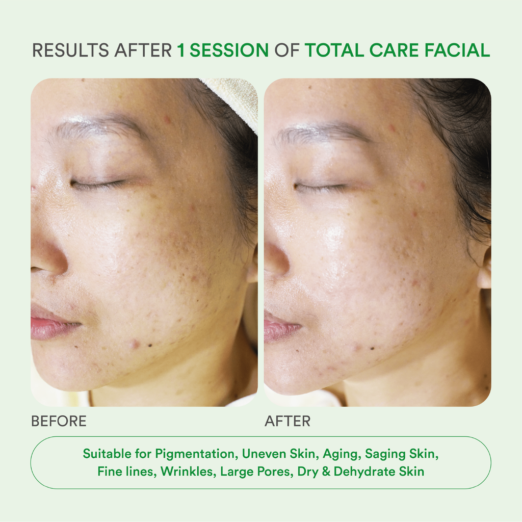 Total Care Facial